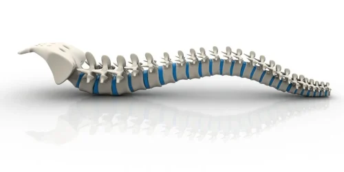 Animated Spine Showing Herniation