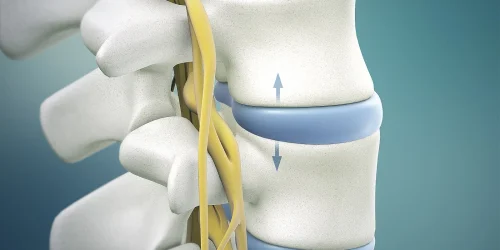 Spinal_Decompression