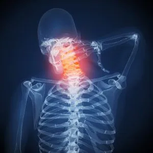 X-ray illustration of a human skeleton with a highlighted red neck, indicating pain or injury.