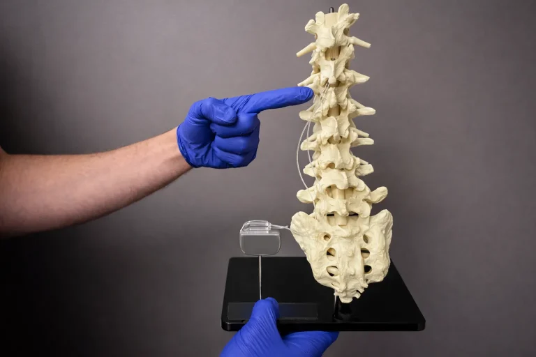 Gloved hand pointing at a spine model with an attached device.