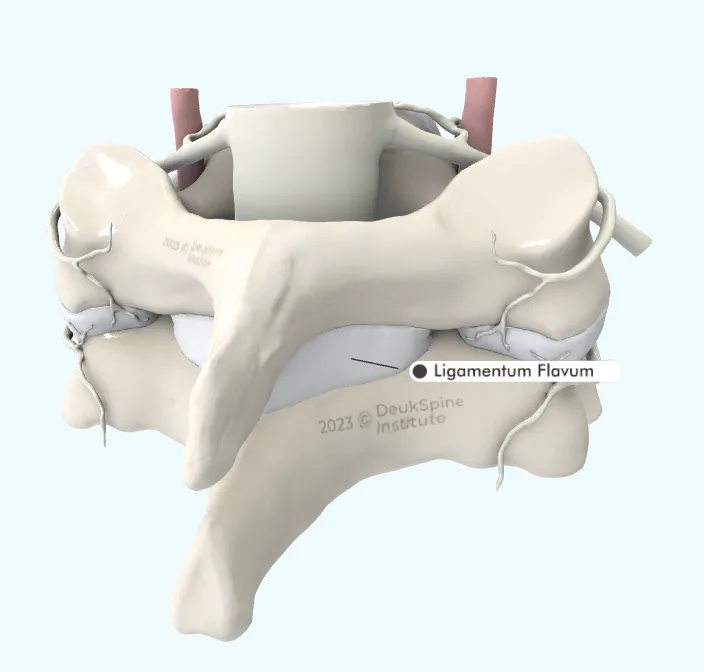 D model of spinal vertebrae highlighting the Ligamentum Flavum.
