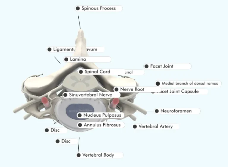 Annotated diagram of spinal anatomy, highlighting parts like the spinal cord, vertebral body, and facet joint.