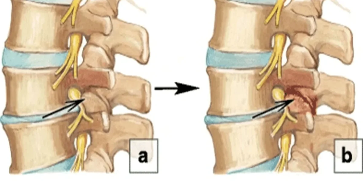 Diagram showing spinal segment.