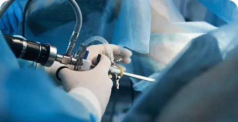Surgeon performing a robotic-assisted laparoscopic procedure in an operating room.