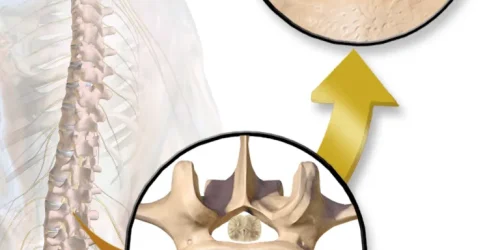Illustration of spinal column and close-ups of vertebral canal
